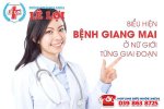 Bieu-hien-Benh-giang-mai-o-nu-gioi-tung-giai-doan-600x400.jpg